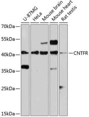 Western Blot: CNTFR Antibody [NBP2-92414] - Analysis of extracts of various cell lines, using CNTFR at 1:3000 dilution.Secondary antibody: HRP Goat Anti-Rabbit IgG (H+L) at 1:10000 dilution.Lysates/proteins: 25ug per lane.Blocking buffer: 3% nonfat dry milk in TBST.Detection: ECL Basic Kit .Exposure time: 10s.