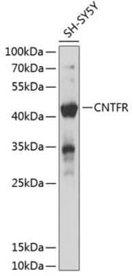 Western Blot: CNTFR Antibody [NBP2-92702] - Analysis of extracts of SH-SY5Y cells, using CNTFR at 1:1000 dilution.Secondary antibody: HRP Goat Anti-Rabbit IgG (H+L) at 1:10000 dilution.Lysates/proteins: 25ug per lane.Blocking buffer: 3% nonfat dry milk in TBST.Detection: ECL Basic Kit .Exposure time: 3s.