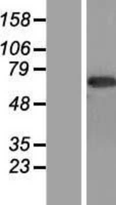Western Blot: CNTFR Overexpression Lysate (Adult Normal) [NBP2-08172] Left-Empty vector transfected control cell lysate (HEK293 cell lysate); Right -Over-expression Lysate for CNTFR.
