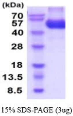 SDS-PAGE Recombinant Rat CNTFR His Protein