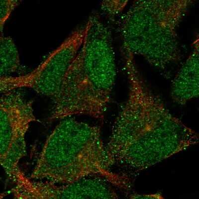 Immunocytochemistry/Immunofluorescence: CNTLN Antibody [NBP2-58899] - Staining of human cell line AF22 shows localization to nucleoplasm, cytosol & centrosome.