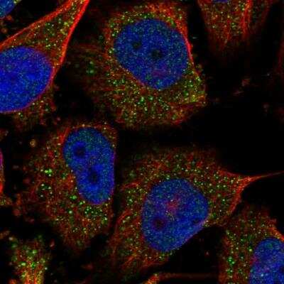 Immunocytochemistry/Immunofluorescence: COASY Antibody [NBP1-84989] - Staining of human cell line U-251 MG shows localization to nucleoplasm & cytosol. Antibody staining is shown in green.