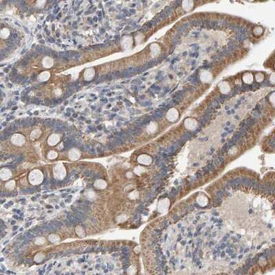 Immunohistochemistry-Paraffin: COASY Antibody [NBP1-84989] - Staining of human duodenum shows moderate cytoplasmic positivity in glandular cells.