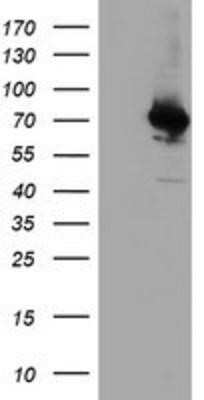 Western Blot: COASY Antibody (OTI3B3) [NBP2-01081] - HEK293T cells were transfected with the pCMV6-ENTRY control (Left lane) or pCMV6-ENTRY COASY (Right lane) cDNA for 48 hrs and lysed. Equivalent amounts of cell lysates (5 ug per lane) were separated by SDS-PAGE and immunoblotted with anti-COASY.