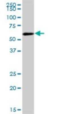 Western Blot: COASY Antibody [H00080347-B01P] - Analysis of COASY expression in human liver.