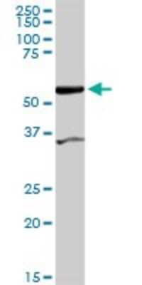 Western Blot: COASY Antibody [H00080347-D01P] - Analysis of COASY expression in mouse spleen.