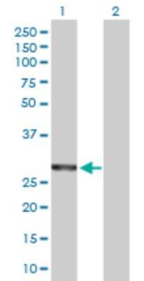 Western Blot: COASY Antibody [H00080347-D01P] - Analysis of COASY expression in transfected 293T cell line by COASY polyclonal antibody.Lane 1: COASY transfected lysate(30.20 KDa).Lane 2: Non-transfected lysate.