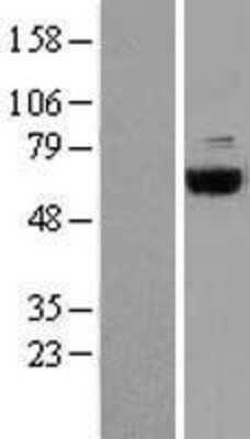 Western Blot: COASY Overexpression Lysate (Adult Normal) [NBP2-08383] Left-Empty vector transfected control cell lysate (HEK293 cell lysate); Right -Over-expression Lysate for COASY.