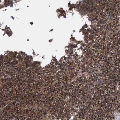 Immunohistochemistry-Paraffin: COBL Antibody [NBP1-89615] - Staining of human parathyroid gland shows high expression.