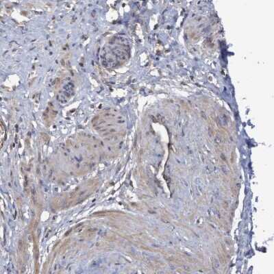 Immunohistochemistry-Paraffin: COBL Antibody [NBP1-89615] - Staining of human smooth muscle shows low expression as expected.