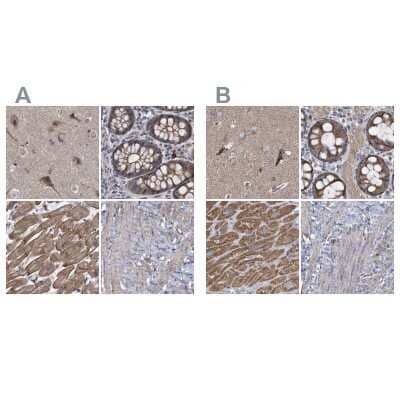 <b>Independent Antibodies Validation and Orthogonal Strategies Validation.</b>Immunohistochemistry-Paraffin: COBL Antibody [NBP1-89615] - Staining of human cerebral cortex, colon, heart muscle and smooth muscle using Anti-COBL antibody NBP1-89615 (A) shows similar protein distribution across tissues to independent antibody NBP1-89616 (B).