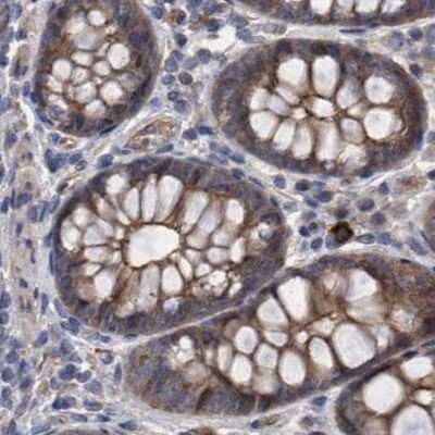 Immunohistochemistry-Paraffin: COBL Antibody [NBP1-89615] - Staining of human colon.