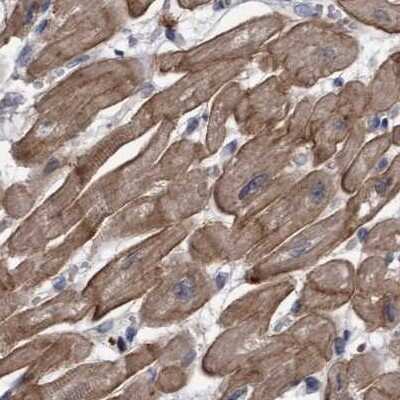 Immunohistochemistry-Paraffin: COBL Antibody [NBP1-89615] - Staining of human heart muscle.