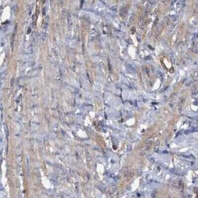 Immunohistochemistry-Paraffin: COBL Antibody [NBP1-89615] - Staining of human smooth muscle using Anti-COBL antibody NBP1-89615.
