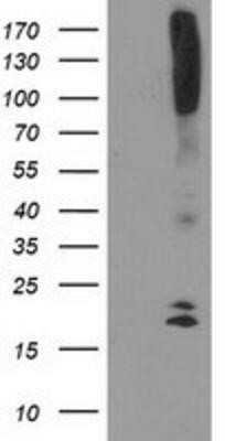 Flow Cytometry: COCO/DAND5 Antibody (OTI2H3) - Azide and BSA Free [NBP2-72456] - HEK293T cells were transfected with the pCMV6-ENTRY control (Left lane) or pCMV6-ENTRY DAND5 (Right lane) cDNA for 48 hrs and lysed. Equivalent amounts of cell lysates (5 ug per lane) were separated by SDS-PAGE and immunoblotted with anti-DAND5.