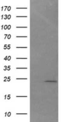 Western Blot: COCO/DAND5 Antibody (OTI3D4) - Azide and BSA Free [NBP2-72457] - Analysis of HEK293T cells were transfected with the pCMV6-ENTRY control (Left lane) or pCMV6-ENTRY DAND5.