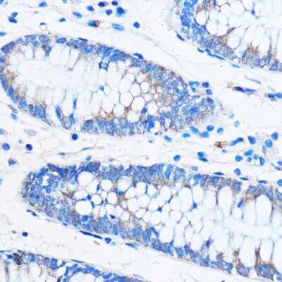 Immunohistochemistry-Paraffin: COG1 Antibody [NBP3-15543] - Immunohistochemistry of paraffin-embedded Human colon using COG1 Rabbit pAb (NBP3-15543) at dilution of 1:50 (40x lens).Perform microwave antigen retrieval with 10 mM PBS buffer pH 7.2 before commencing with IHC staining protocol.