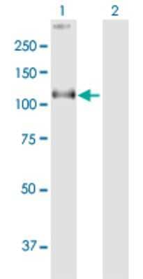 Western Blot: COG1 Antibody [H00009382-B01P] - Analysis of COG1 expression in transfected 293T cell line by COG1 polyclonal antibody.  Lane 1: COG1 transfected lysate(107.8 KDa). Lane 2: Non-transfected lysate.