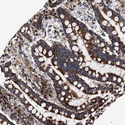 Immunohistochemistry-Paraffin: COG5 Antibody [NBP1-93713] - Staining of human colon shows strong cytoplasmic positivity in granular pattern in glandular cells.