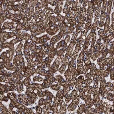 Immunohistochemistry-Paraffin: COG5 Antibody [NBP1-93713] - Staining of human Liver shows strong granular cytoplasmic positivity in  hepatocytes.