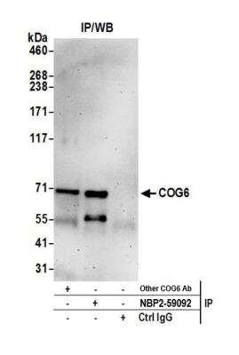 Immunoprecipitation: COG6 Antibody [NBP2-59092] - Detection of human COG6 by western blot of immunoprecipitates. Samples: Whole cell lysate (0.5 or 1.0 mg per IP reaction; 20% of IP loaded) from Jurkat cells prepared using NETN lysis buffer. Antibodies: Affinity purified rabbit anti-COG6 antibody NBP2-59092 used for IP at 20 ul per reaction. COG6 was also immunoprecipitated by another rabbit anti-COG6 antibody. For blotting immunoprecipitated COG6, NBP2-59092 was used at 1:400. Detection: Chemiluminescence with an exposure time of 3 minutes.