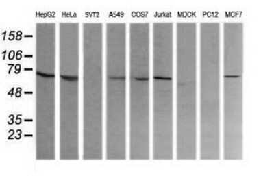 Western Blot: COG6 Antibody (OTI1B8) - Azide and BSA Free [NBP2-72088] - Analysis of extracts (35ug) from 9 different cell lines. (HepG2: human; HeLa: human; SVT2: mouse; A549: human; COS7: monkey; Jurkat: human; MDCK: canine; PC12: rat; MCF7: human).