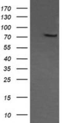 Western Blot: COG6 Antibody (OTI1B8) - Azide and BSA Free [NBP2-72088] - Analysis of HEK293T cells were transfected with the pCMV6-ENTRY control (Left lane) or pCMV6-ENTRY COG6.