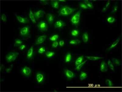 Immunocytochemistry/Immunofluorescence: COG7 Antibody (3G4-1B3) [H00091949-M01] - Analysis of monoclonal antibody to COG7 on HeLa cell. Antibody concentration 10 ug/ml.