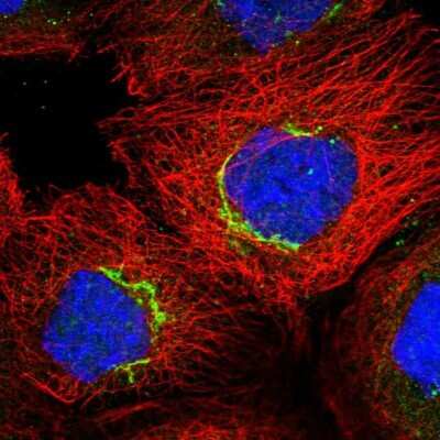 Immunocytochemistry/Immunofluorescence: COG7 Antibody [NBP2-47502] - Staining of human cell line A-431 shows localization to the Golgi apparatus. Antibody staining is shown in green.