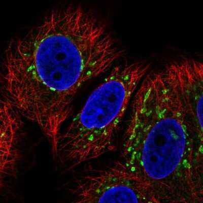 Immunocytochemistry/Immunofluorescence: COG7 Antibody [NBP2-56614] - Staining of human cell line MCF7 shows localization to the Golgi apparatus.