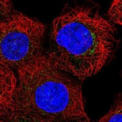 Immunocytochemistry/Immunofluorescence: COG7 Antibody [NBP3-17820] - Staining of human cell line A-431 shows localization to the Golgi apparatus & vesicles.