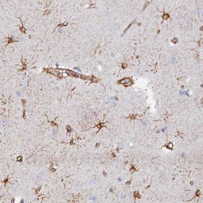 Immunohistochemistry-Paraffin: COG7 Antibody [NBP2-47502] - Staining of human lateral ventricle shows strong cytoplasmic positivity in astrocytes.