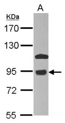 Western Blot: COG7 Antibody [NBP2-14914] - Sample (20 ug of whole cell lysate) A: HeLa membrane 7. 5% SDS PAGE; antibody diluted at 1:1000.