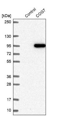 Western Blot: COG7 Antibody [NBP2-47502] - Analysis in control (vector only transfected HEK293T lysate) and COG7 over-expression lysate (Co-expressed with a C-terminal myc-DDK tag (3.1 kDa) in mammalian HEK293T cells).