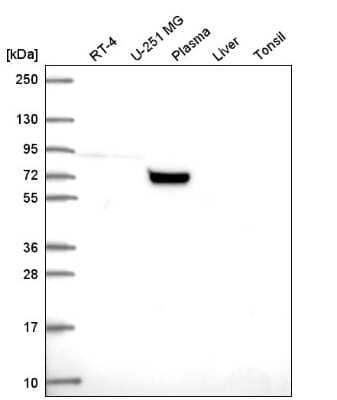 Western Blot: COG7 Antibody [NBP2-56614] - Western blot analysis in human cell line RT-4, human cell line U-251 MG, human plasma, human liver tissue and human tonsil tissue.