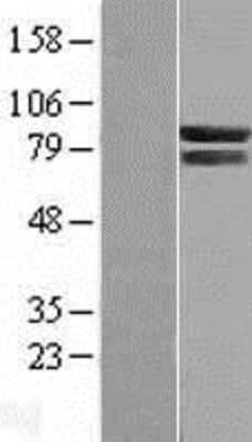 Western Blot: COG7 Overexpression Lysate (Adult Normal) [NBL1-09346] Left-Empty vector transfected control cell lysate (HEK293 cell lysate); Right -Over-expression Lysate for COG7.