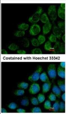 Immunocytochemistry/Immunofluorescence: COG8 Antibody [NBP2-15938] - Immunofluorescence analysis of methanol-fixed A431, using antibody at 1:500 dilution.