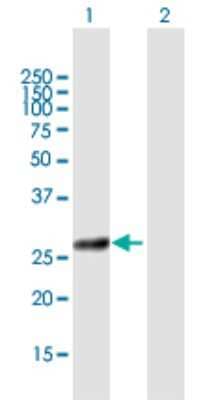 Western Blot: COG8 Antibody [H00084342-B01P] - Analysis of COG8 expression in transfected 293T cell line by COG8 polyclonal antibody.  Lane 1: COG8 transfected lysate(24.09 KDa). Lane 2: Non-transfected lysate.