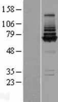 Western Blot: COG8 Overexpression Lysate (Adult Normal) [NBP2-06042] Left-Empty vector transfected control cell lysate (HEK293 cell lysate); Right -Over-expression Lysate for COG8.