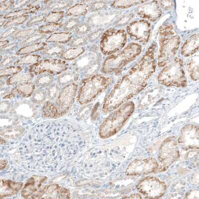 Immunohistochemistry-Paraffin COL14A1 Antibody