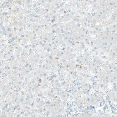 Immunohistochemistry-Paraffin COL14A1 Antibody