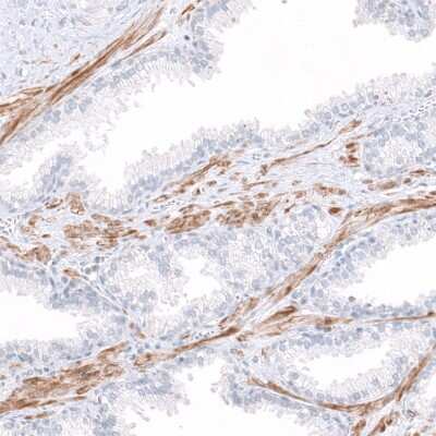 Immunohistochemistry-Paraffin: COL14A1 Antibody [NBP1-86877] - Staining of human prostate shows positivity in smooth muscle cells.