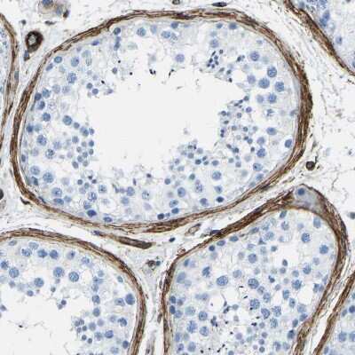 Immunohistochemistry-Paraffin: COL15A1 Antibody [NBP1-91087] - Staining of human testis shows strong positivity in peritubular myoid cells.