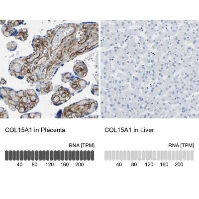 <b>Orthogonal Strategies Validation. </b>Immunohistochemistry-Paraffin: COL15A1 Antibody [NBP1-91087] - Analysis in human placenta and liver tissues using NBP1-91087 antibody. Corresponding COL15A1 RNA-seq data are presented for the same tissues.