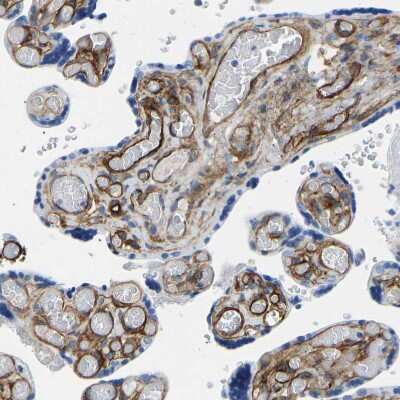 Immunohistochemistry-Paraffin: COL15A1 Antibody [NBP1-91087] - Staining of human placenta shows strong positivity in extracellular matrix in villi.
