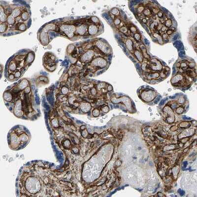 Immunohistochemistry-Paraffin: COL15A1 Antibody [NBP1-91088] - Staining of human placenta shows strong positivity in extracellular matrix in villi.
