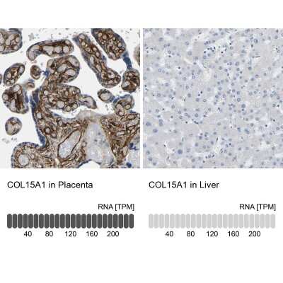 Immunohistochemistry-Paraffin: COL15A1 Antibody [NBP1-91088] - Analysis in human placenta and liver tissues using NBP1-91088 antibody. Corresponding COL15A1 RNA-seq data are presented for the same tissues.