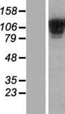 Western Blot: COL19A1 Overexpression Lysate (Adult Normal) [NBP2-08170] Left-Empty vector transfected control cell lysate (HEK293 cell lysate); Right -Over-expression Lysate for COL19A1.