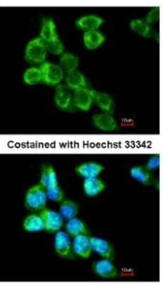 Immunocytochemistry/ Immunofluorescence COL4A3BP Antibody