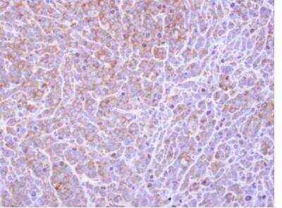 Immunohistochemistry-Paraffin COL4A3BP Antibody